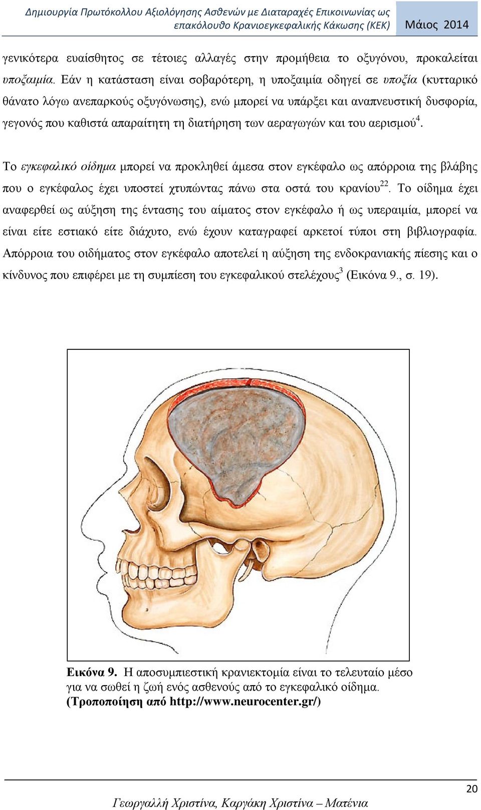 διατήρηση των αεραγωγών και του αερισμού 4. Το εγκεφαλικό οίδημα μπορεί να προκληθεί άμεσα στον εγκέφαλο ως απόρροια της βλάβης που ο εγκέφαλος έχει υποστεί χτυπώντας πάνω στα οστά του κρανίου 22.