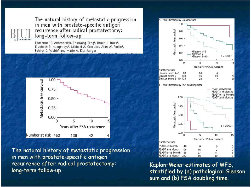 prostatectomy: long term follow up Kaplan Meier estimates of