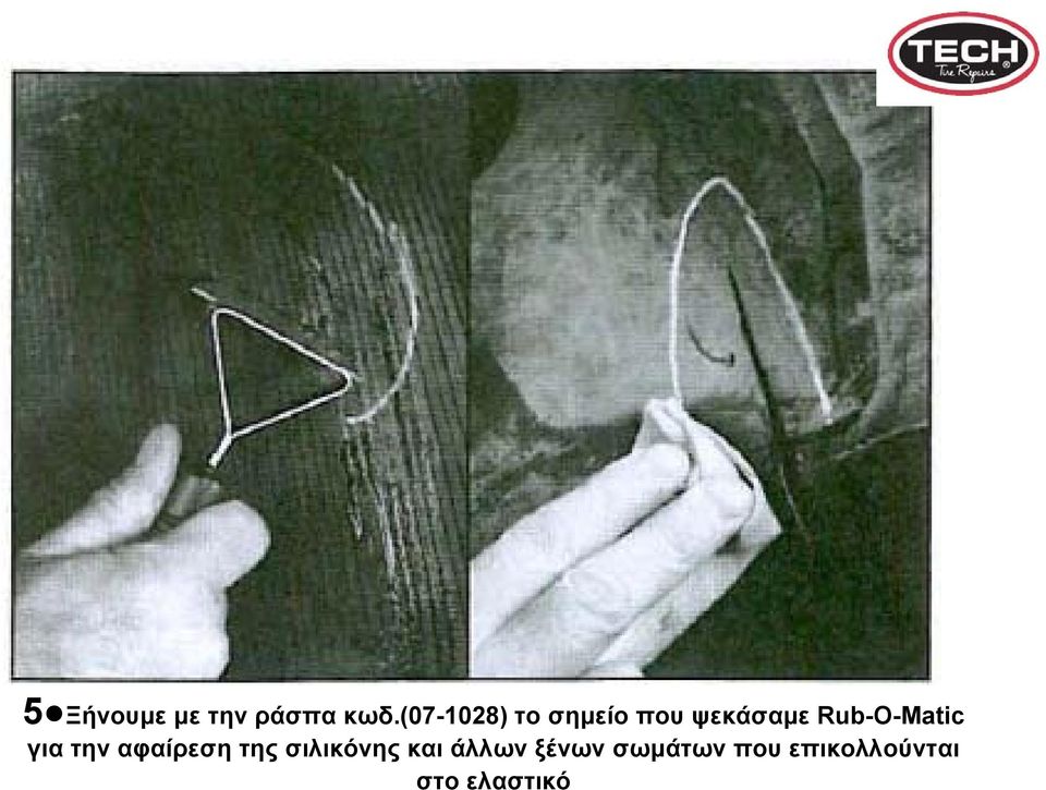 Rub-O-Matic για την αφαίρεση της