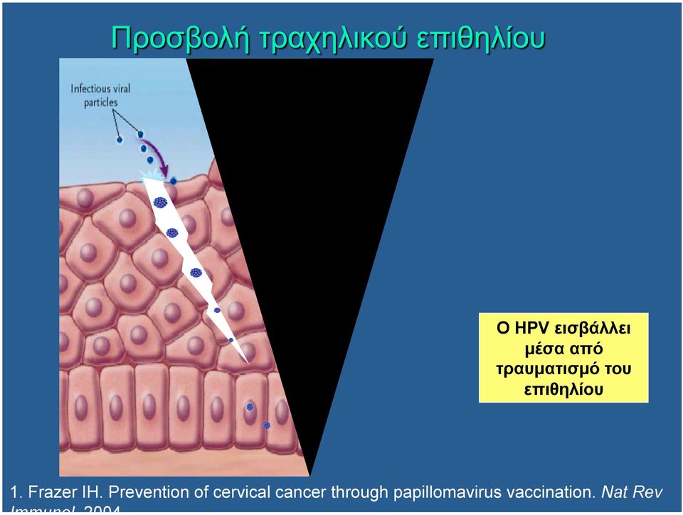 Prevention of cervical cancer through