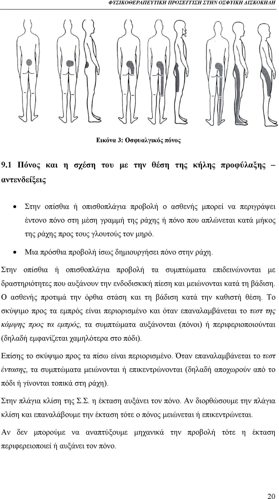 κατά μήκος της ράχης προς τους γλουτούς τον μηρό. Μια πρόσθια προβολή ίσως δημιουργήσει πόνο στην ράχη.