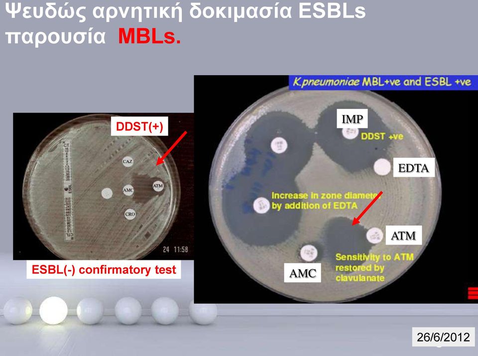 DDST(+) IMP EDTA ATM ESBL(-)