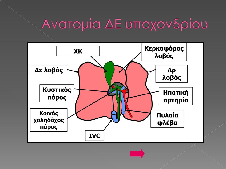 Κοινός χοληδόχος πόρος IVC