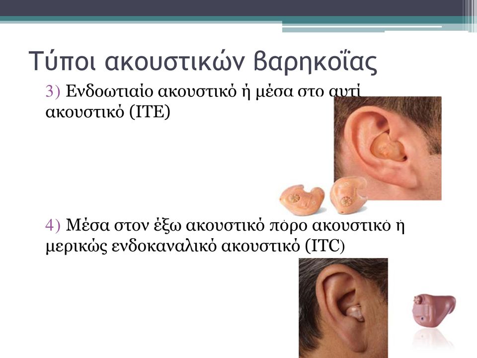 (ΙΤΕ) 4) Μέσα στον έξω ακουστικό πόρο