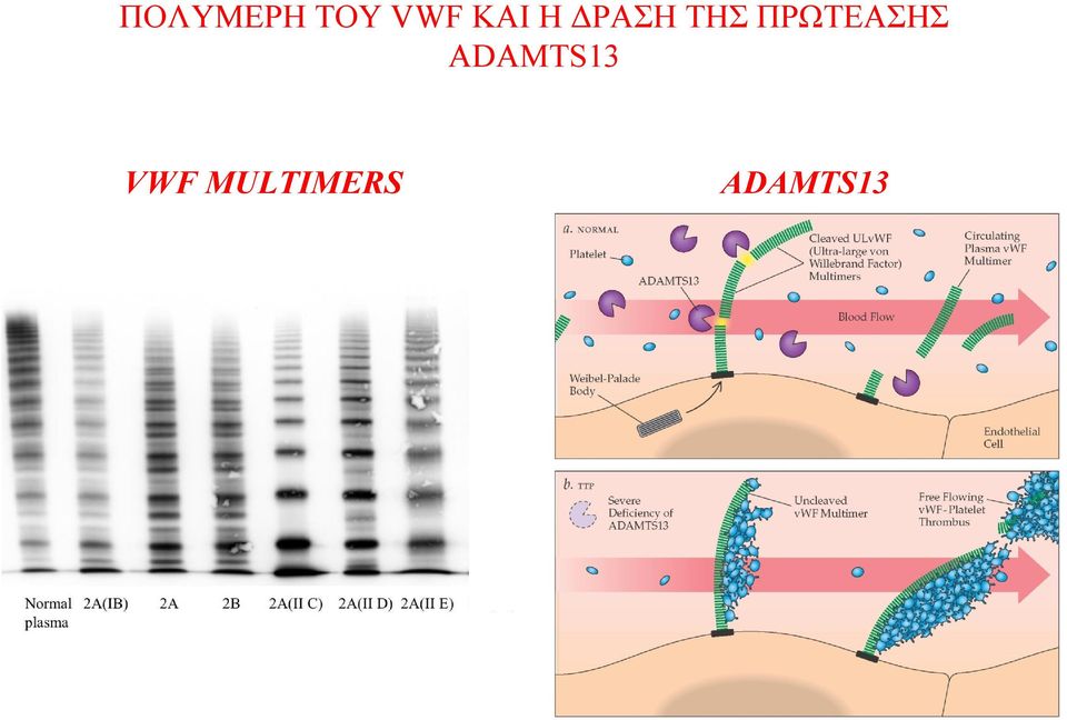 ΠΡΩΤΕΑΣΗΣ ADAMTS13