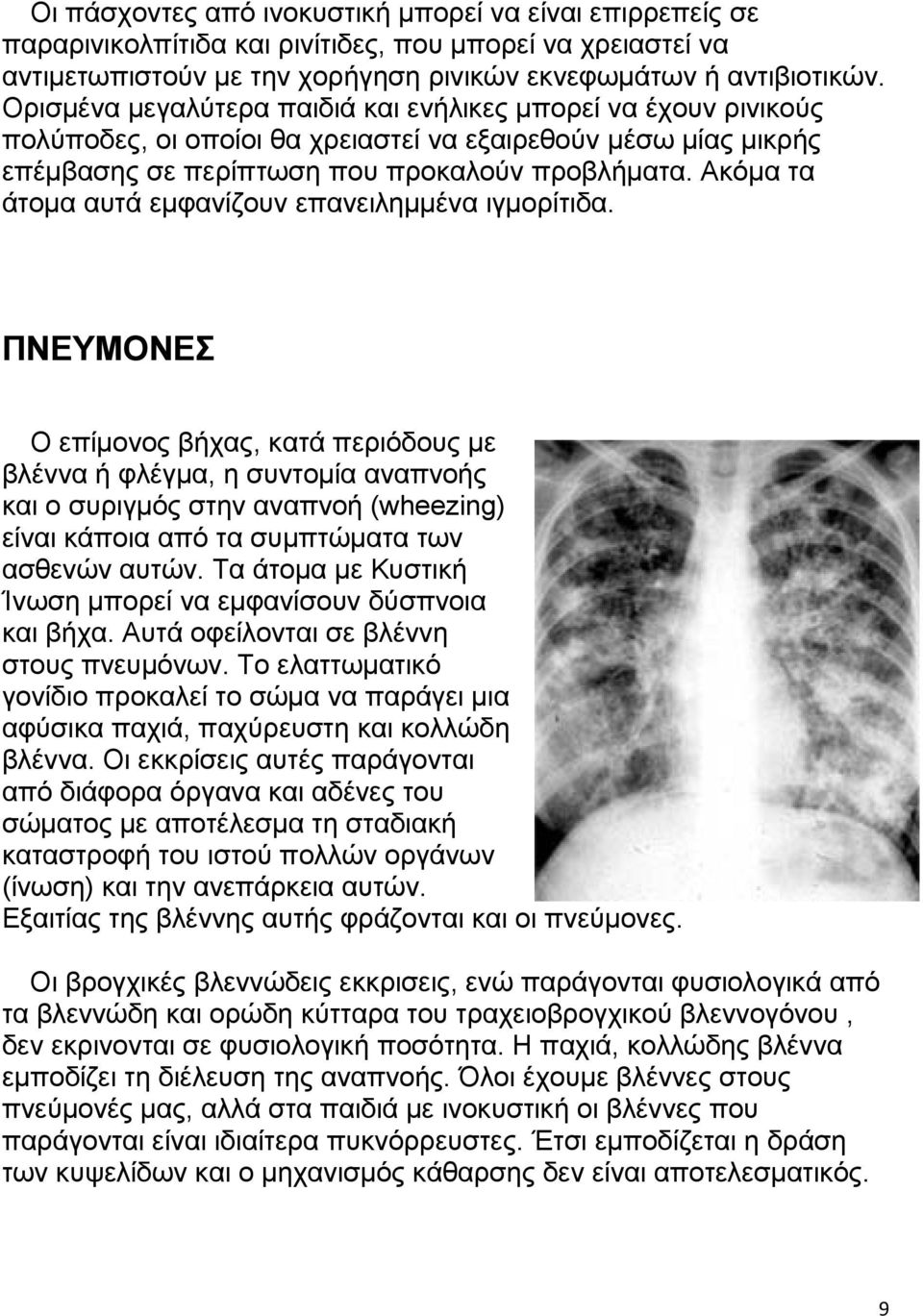 Ακόμα τα άτομα αυτά εμφανίζουν επανειλημμένα ιγμορίτιδα.