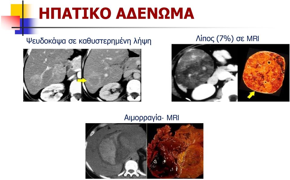 καθυστερημένη λήψη