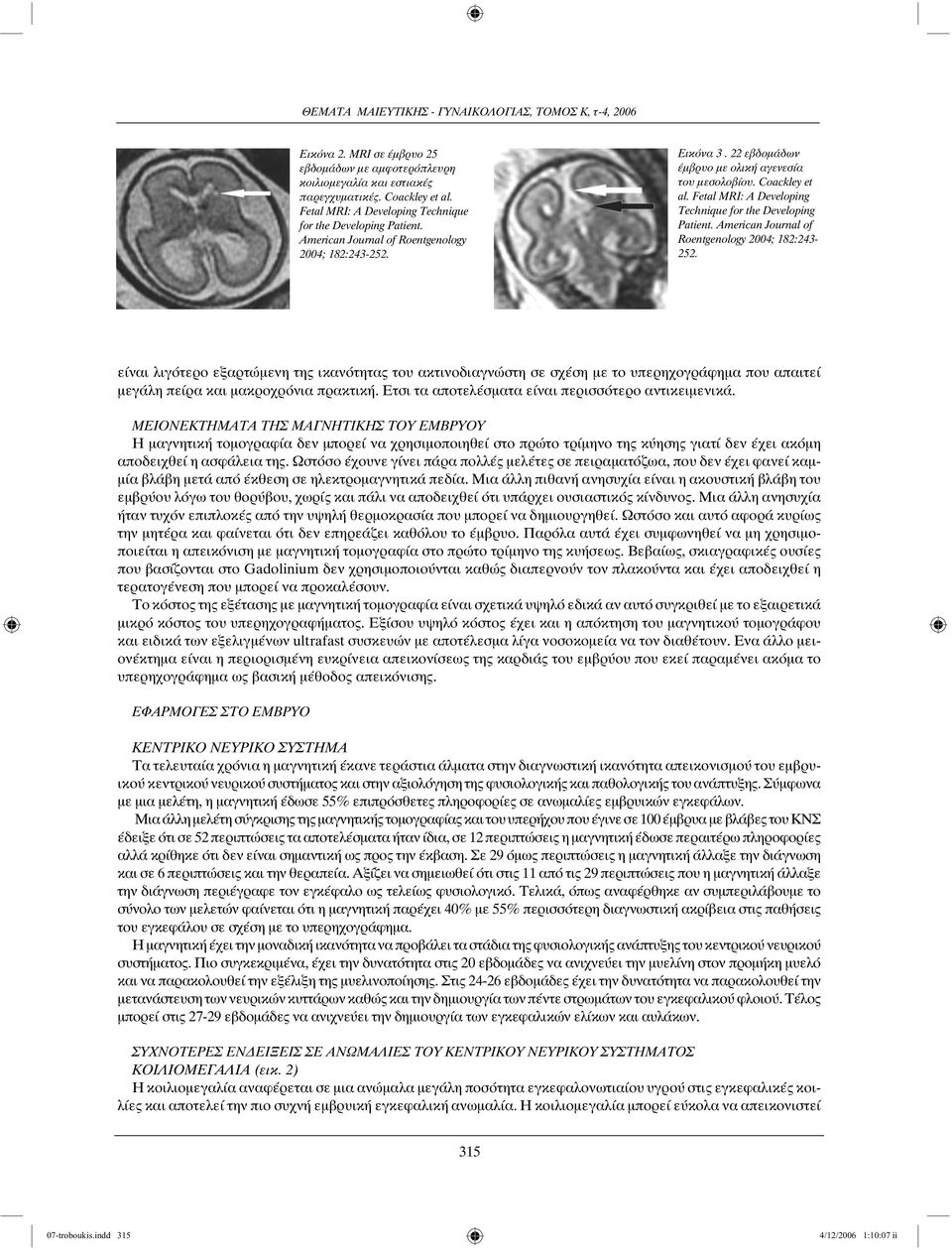 American Journal of Roentgenology 2004; 182:243-252. είναι λιγότερο εξαρτώμενη της ικανότητας του ακτινοδιαγνώστη σε σχέση με το υπερηχογράφημα που απαιτεί μεγάλη πείρα και μακροχρόνια πρακτική.