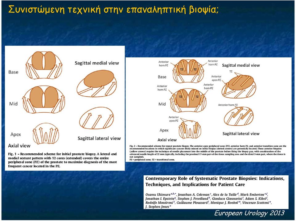 επαναληπτική