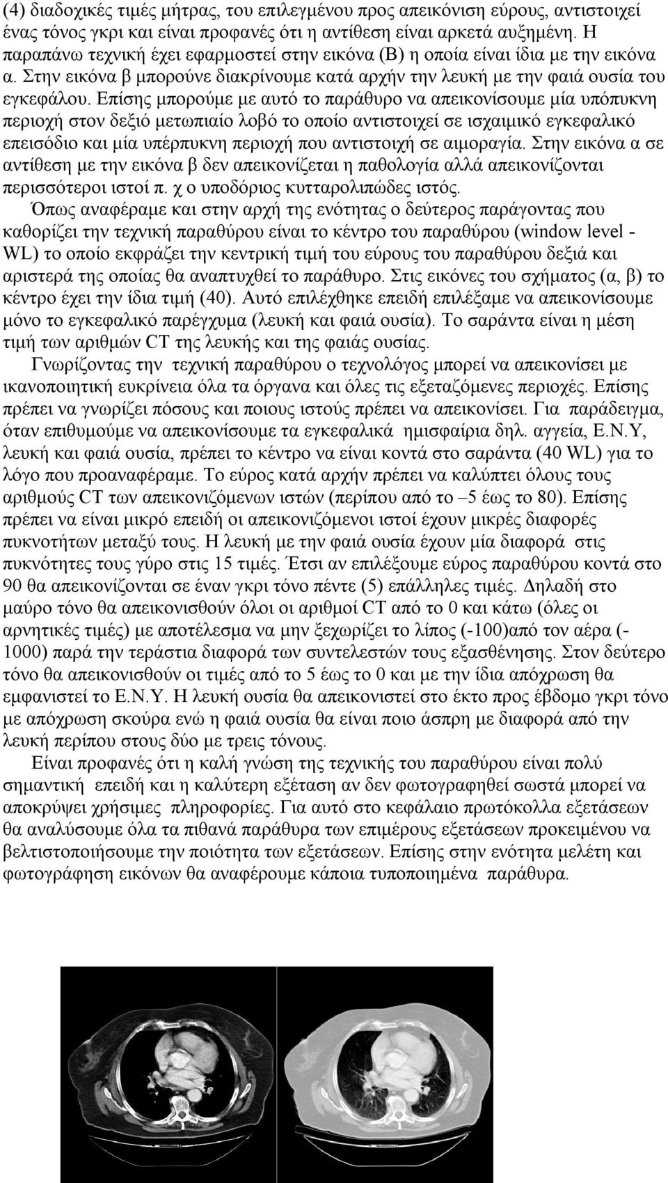 Επίσης μπορούμε με αυτό το παράθυρο να απεικονίσουμε μία υπόπυκνη περιοχή στον δεξιό μετωπιαίο λοβό το οποίο αντιστοιχεί σε ισχαιμικό εγκεφαλικό επεισόδιο και μία υπέρπυκνη περιοχή που αντιστοιχή σε