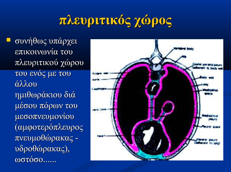 μέσου πόρων του μεσοπνευμονίου (αμφοτερόπλευρος