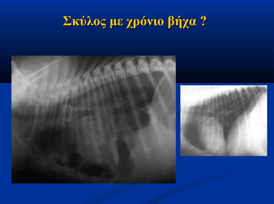 βήχα?