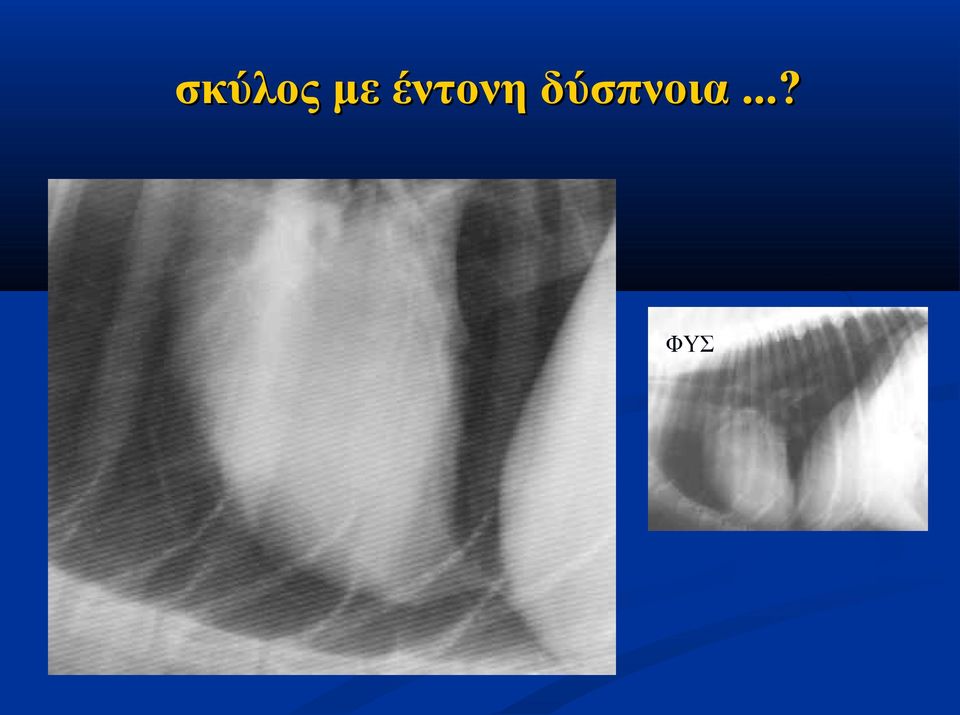 δύσπνοια.