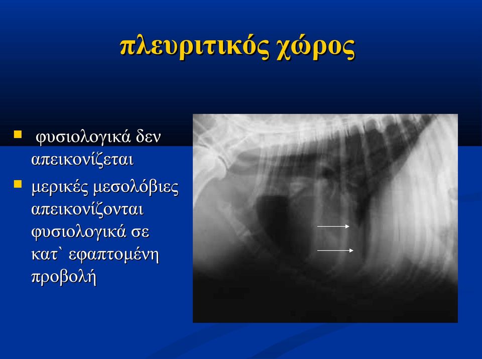 μεσολόβιες απεικονίζονται