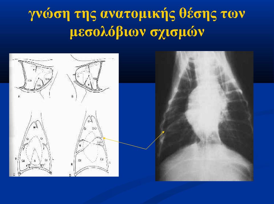 θέσης των