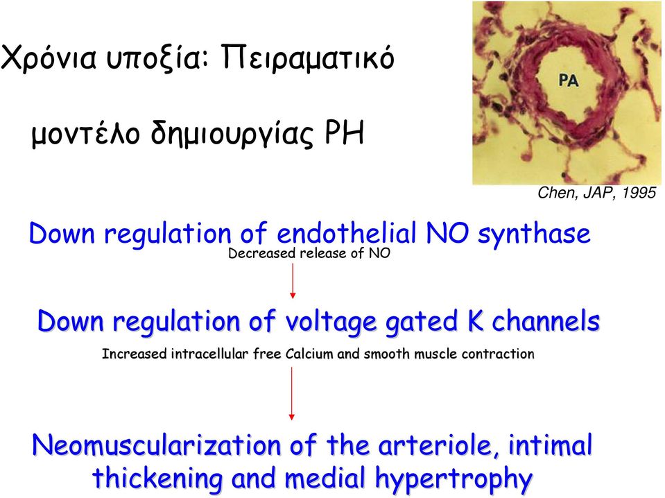 gated K channels Increased intracellular free Calcium and smooth muscle