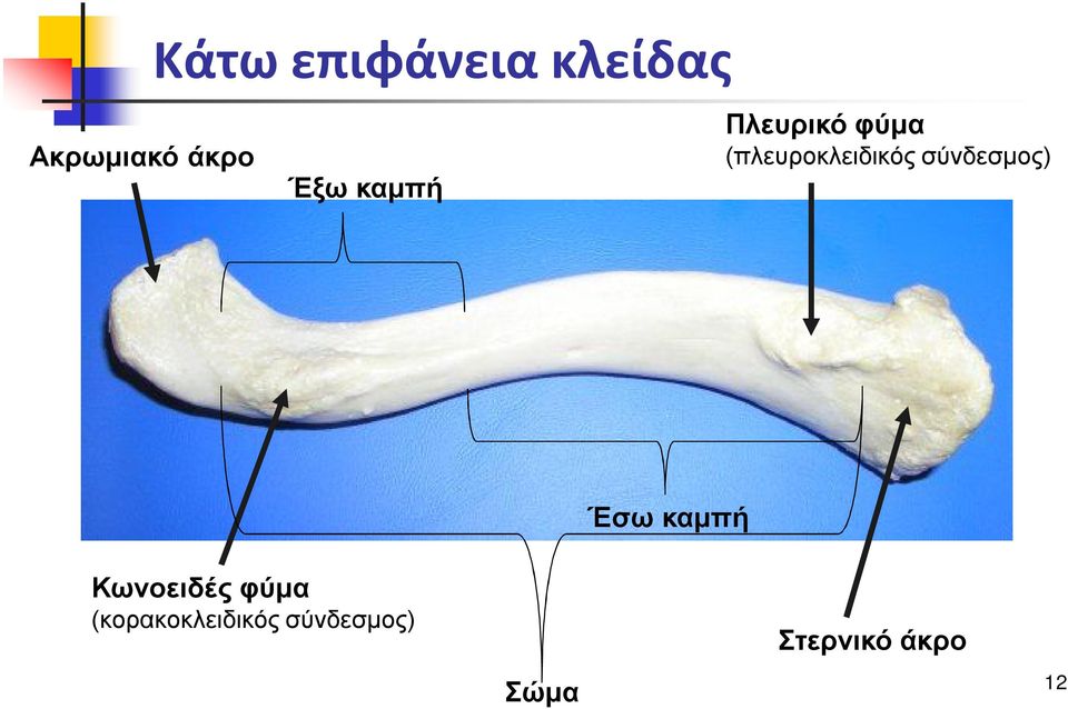 σύνδεσμος) Έσω καμπή Κωνοειδές φύμα