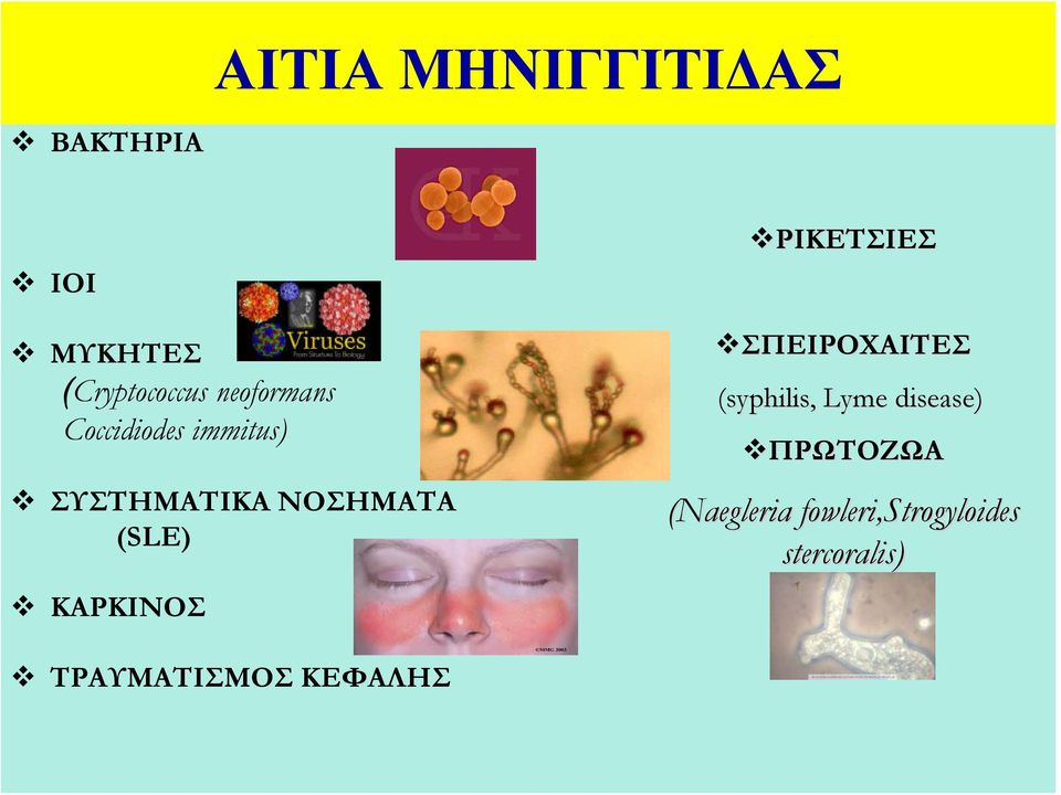 ΚΑΡΚΙΝΟΣ ΡΙΚΕΤΣΙΕΣ ΣΠΕΙΡΟΧΑΙΤΕΣ (syphilis, Lyme disease)