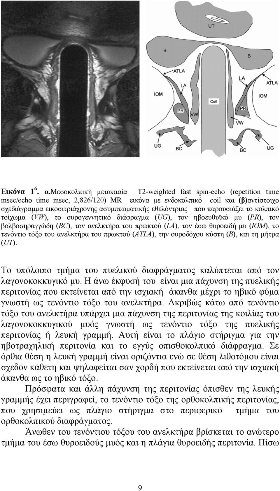 εθελόντριας που παρουσιάζει το κολπικό τοίχωµα (VW), το ουρογεννητικό διάφραγµα (UG), τον ηβοευθυϊκό µυ (PR), τον βολβοσηραγγώδη (BC), τον ανελκτήρα του πρωκτού (LA), τον έσω θυροειδή µυ (IOM), το