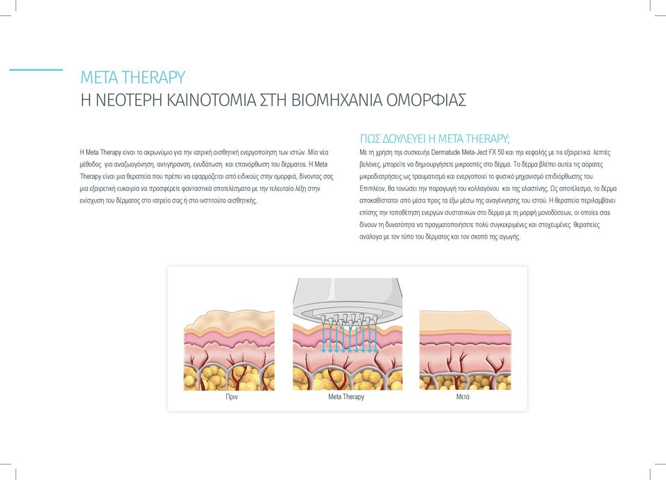 Η Meta Therapy είναι μια θεραπεία που πρέπει να εφαρμόζεται από ειδικούς στην ομορφιά, δίνοντας σας μια εξαιρετική ευκαιρία να προσφέρετε φανταστικά αποτελέσματα με την τελευταία λέξη στην ενίσχυση