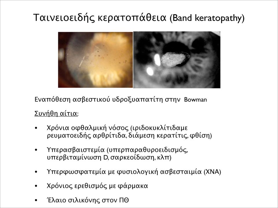 κερατίτις, φθίση) Υπερασβαιστεμία (υπερπαραθυροειδισμός, υπερβιταμίνωση D, σαρκεοίδωση, κλπ)