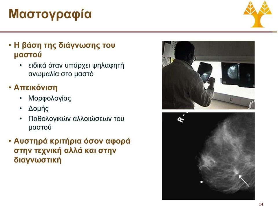 Μορφολογίας Δομής Παθολογικών αλλοιώσεων του μαστού