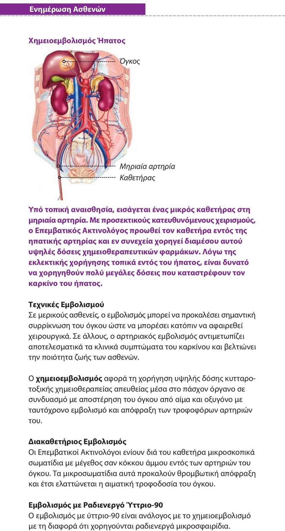 Λόγω της εκλεκτικής χορήγησης τοπικά εντός του ήπατος, είναι δυνατό να χορηγηθούν πολύ μεγάλες δόσεις που καταστρέφουν τον καρκίνο του ήπατος.