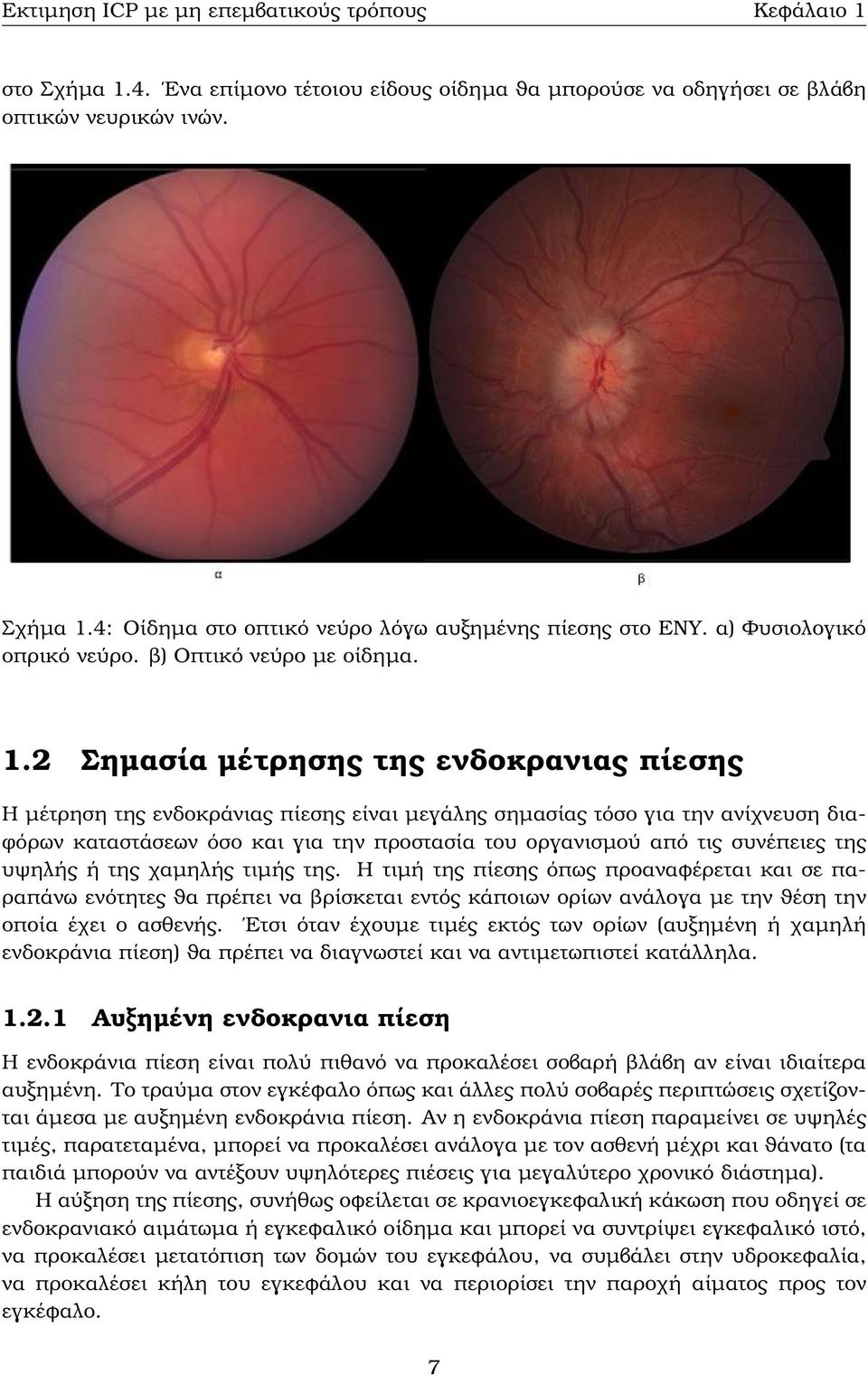 2 Σηµασία µέτρησης της ενδοκρανιας πίεσης Η µέτρηση της ενδοκράνιας πίεσης είναι µεγάλης σηµασίας τόσο για την ανίχνευση δια- ϕόρων καταστάσεων όσο και για την προστασία του οργανισµού από τις