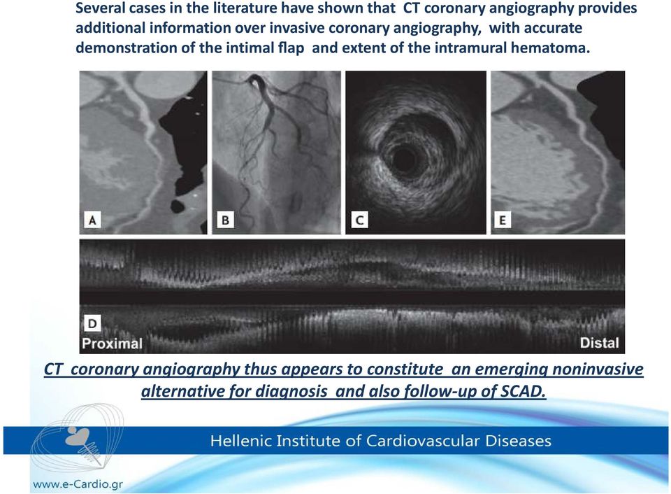 of the intimal flap and extent of the intramural hematoma.