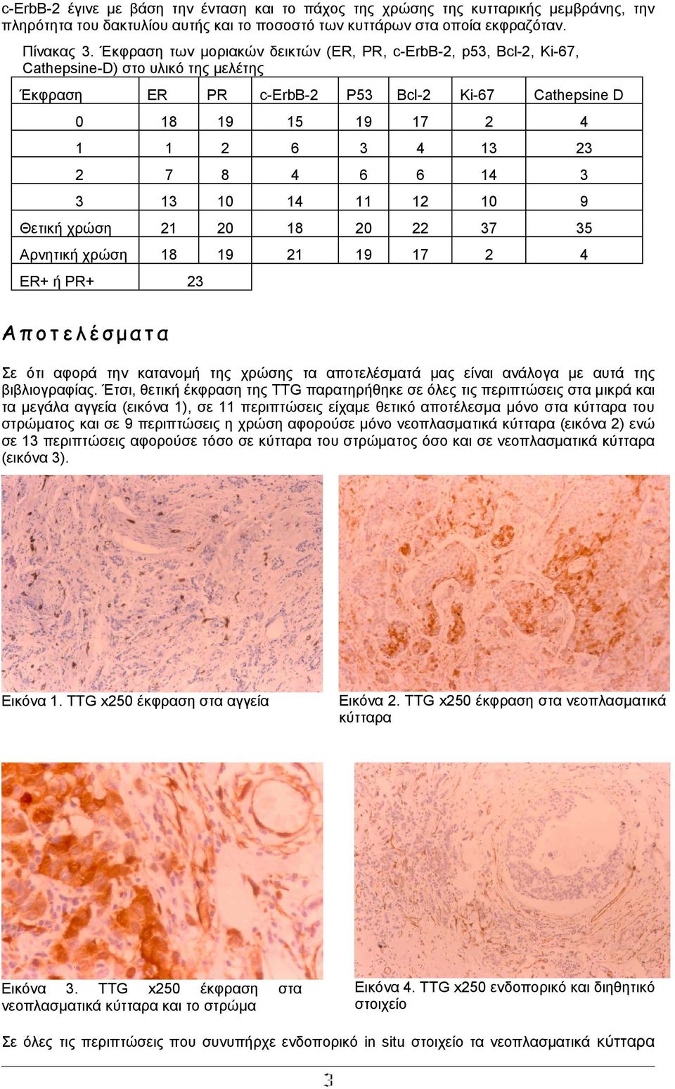 6 6 14 3 3 13 1 14 11 12 1 9 Θετική χρώση 21 2 18 2 22 37 35 Αρνητική χρώση 18 19 21 19 17 2 4 ER+ ή PR+ 23 Α π ο τ ε λ έ σ μ α τ α Σε ότι αφορά την κατανομή της χρώσης τα αποτελέσματά μας είναι