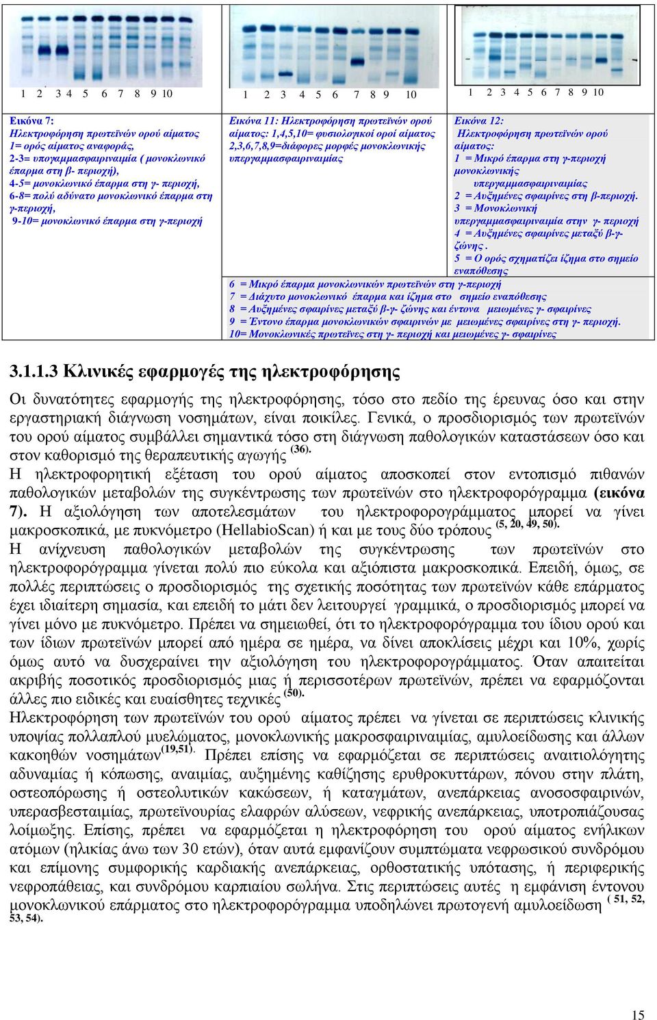 θπζηνινγηθνί νξνί αίκαηνο 2,3,6,7,8,9=δηάθνξεο κνξθέο κνλνθισληθήο ππεξγακκαζθαηξηλαηκίαο Εηθόλα 12: Ηιεθηξνθόξεζε πξσηετλώλ νξνύ αίκαηνο: 1 = Μηθξό έπαξκα ζηε γ-πεξηνρή κνλνθισληθήο