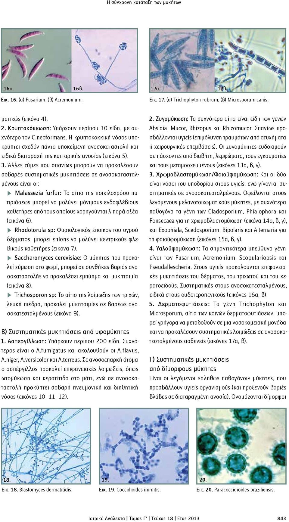 3. Άλλες ζύμες που σπανίως μπορούν να προκαλέσουν σοβαρές συστηματικές μυκητιάσεις σε ανοσοκατασταλμένους είναι οι: n Malassezia furfur: Το αίτιο της ποικιλοχρόου πυτιριάσεως μπορεί να μολύνει