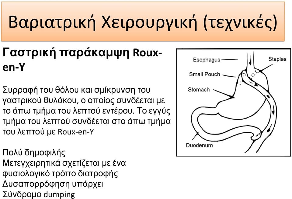 Το εγγύς τμήμα του λεπτού συνδέεται στο άπω τμήμα του λεπτού με Roux en Y Πολύ δημοφιλής