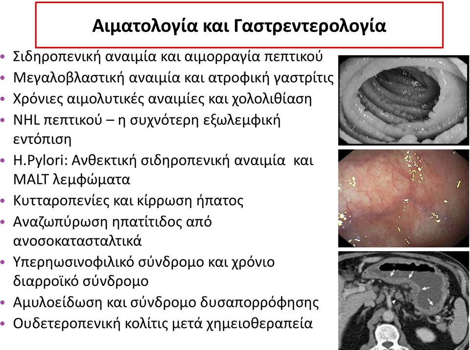 Pylori: Aνθεκτική σιδηροπενική αναιμία και MALT λεμφώματα Κυτταροπενίες και κίρρωση ήπατος Αναζωπύρωση ηπατίτιδος από