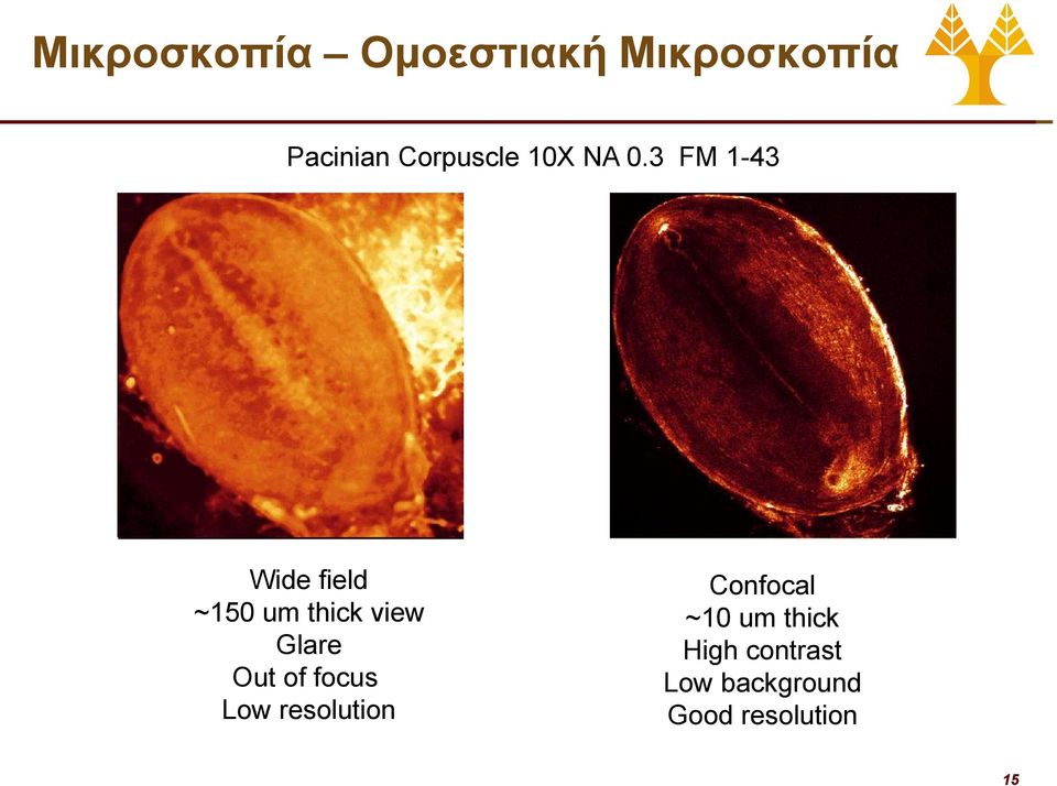 3 FM 1-43 PC Wide field ~15 um thick view Glare