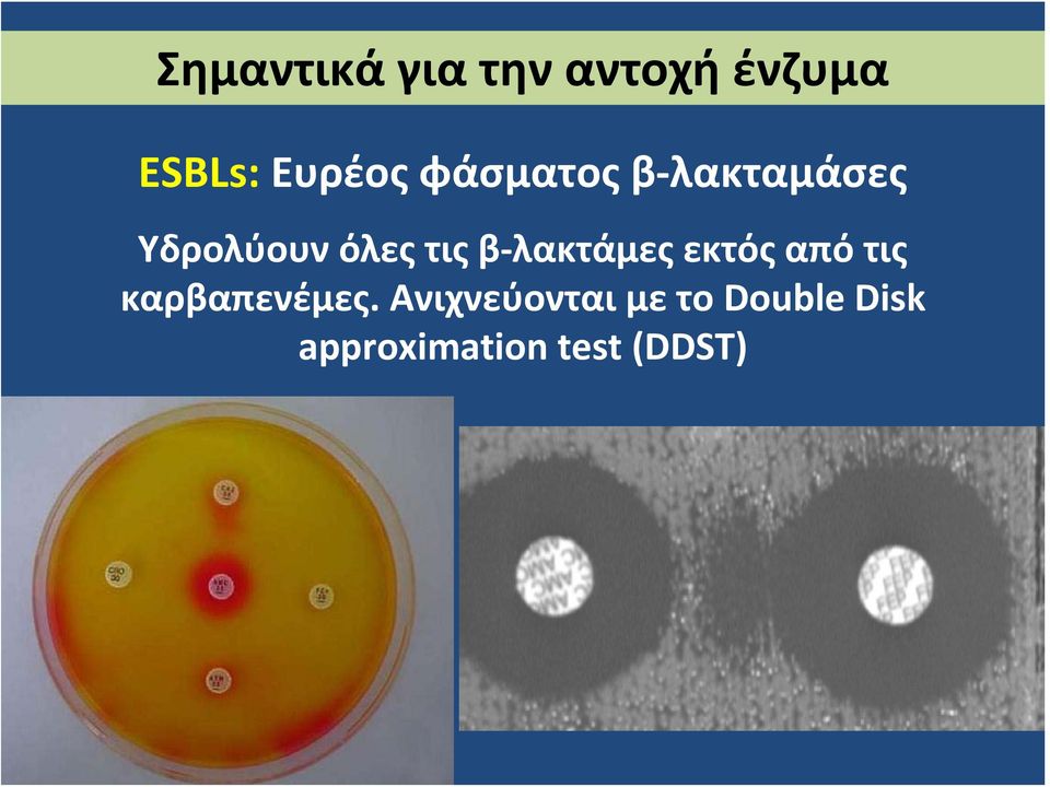 λακτάμες εκτός από τις καρβαπενέμες.