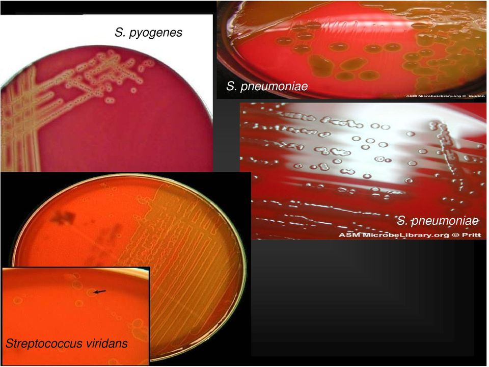 pneumoniae