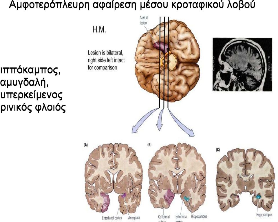 ιππόκαµπος, αµυγδαλή, υπερκείµενος