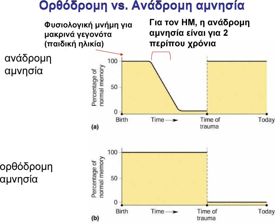 Ανάδροµη αµνησία Φυσιολογική µνήµη για µακρινά