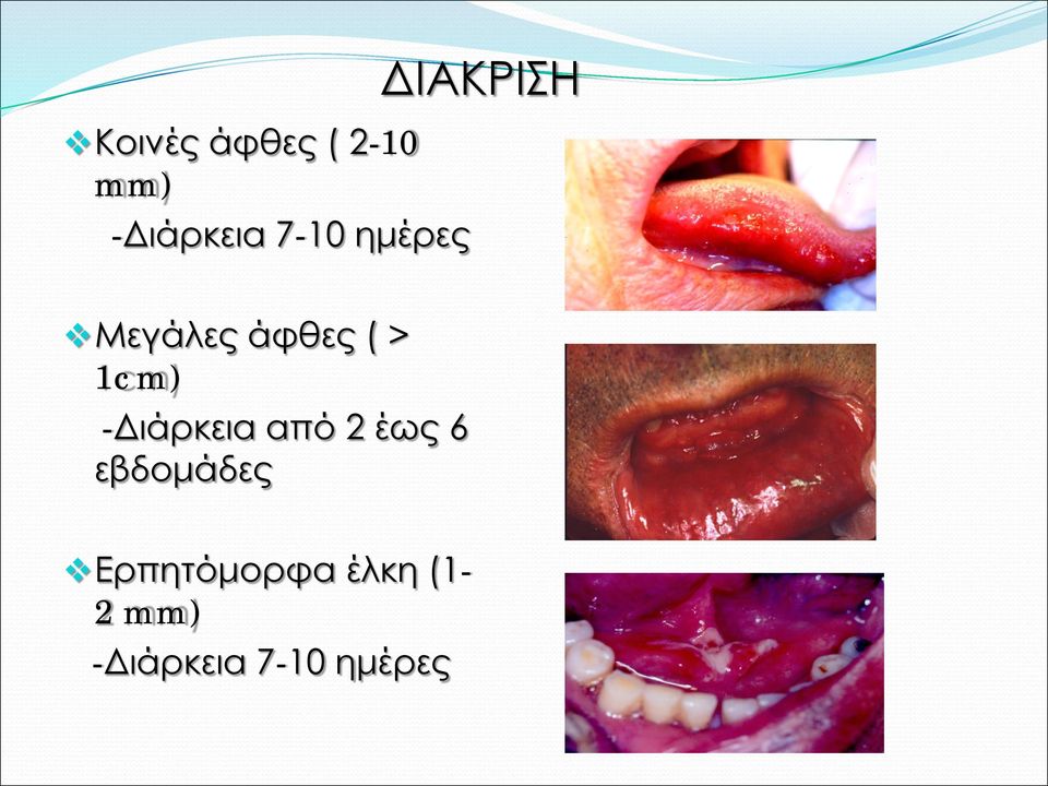 -Διάρκεια από 2 έως 6 εβδομάδες