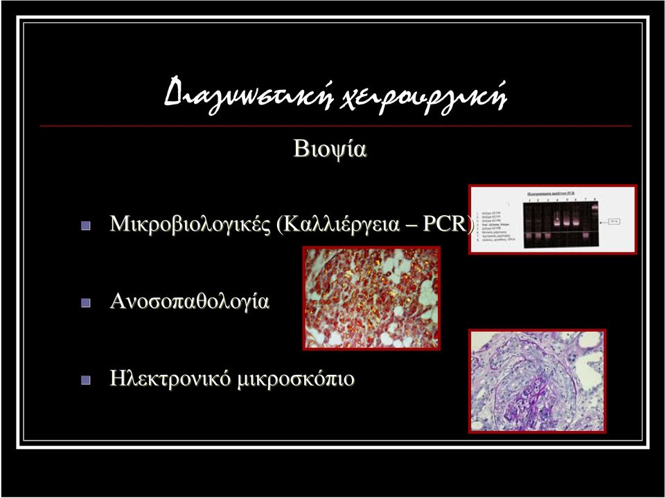 (Καλλιέργεια PCR)