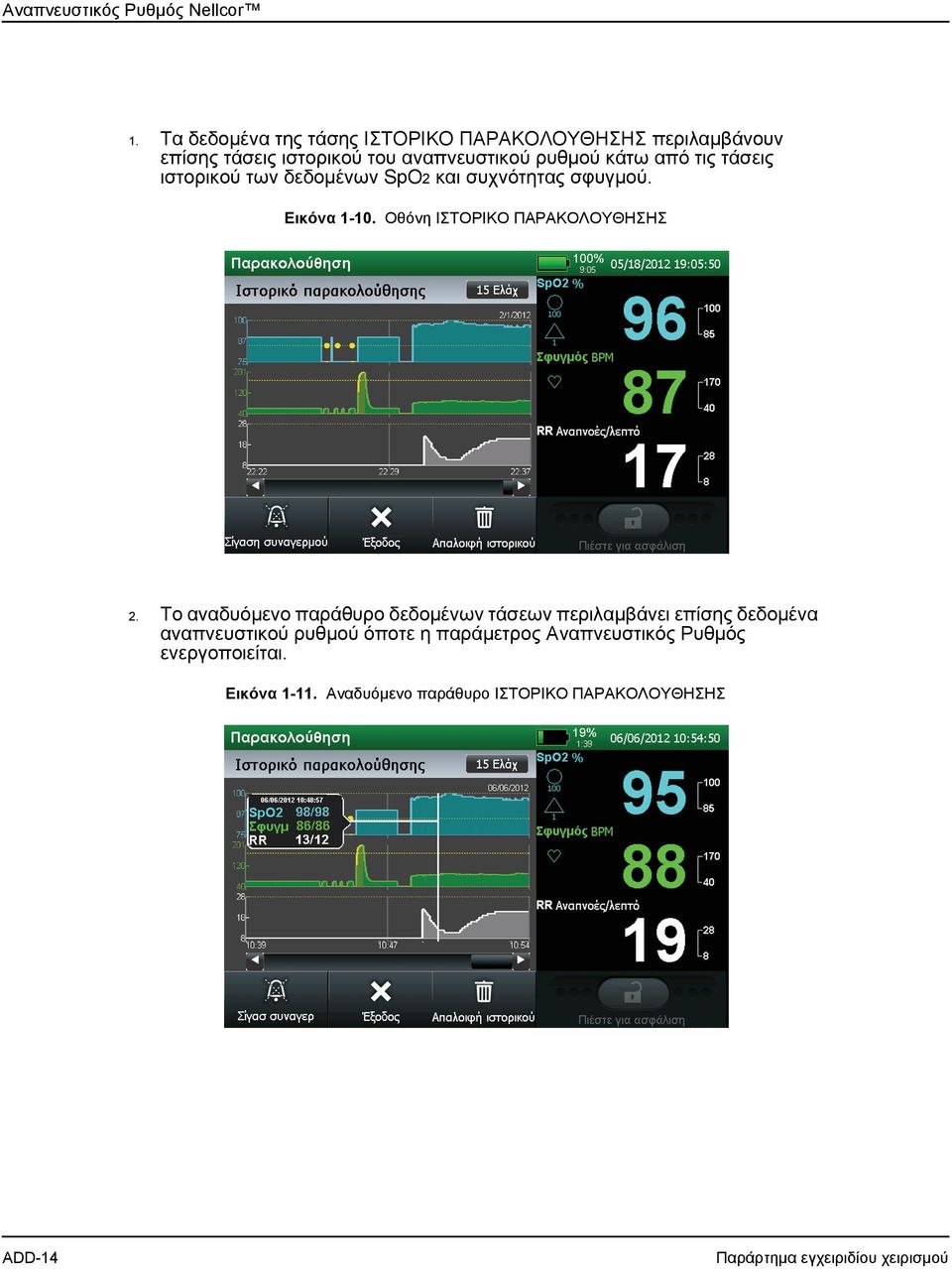 τάσεις ιστορικού των δεδομένων SpO2 και συχνότητας σφυγμού. Εικόνα 1-10. Οθόνη ΙΣΤΟΡΙΚΟ ΠΑΡΑΚΟΛΟΥΘΗΣΗΣ 2.
