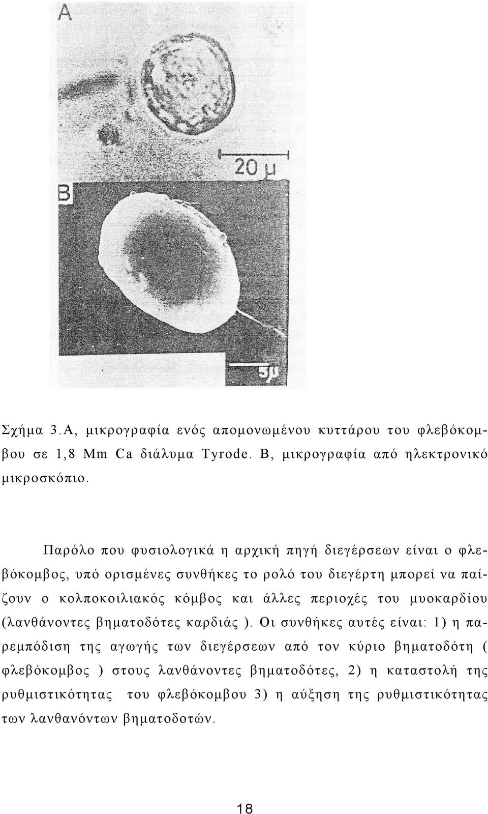 και άλλες περιοχές του µυοκαρδίου (λανθάνοντες βηµατοδότες καρδιάς ).