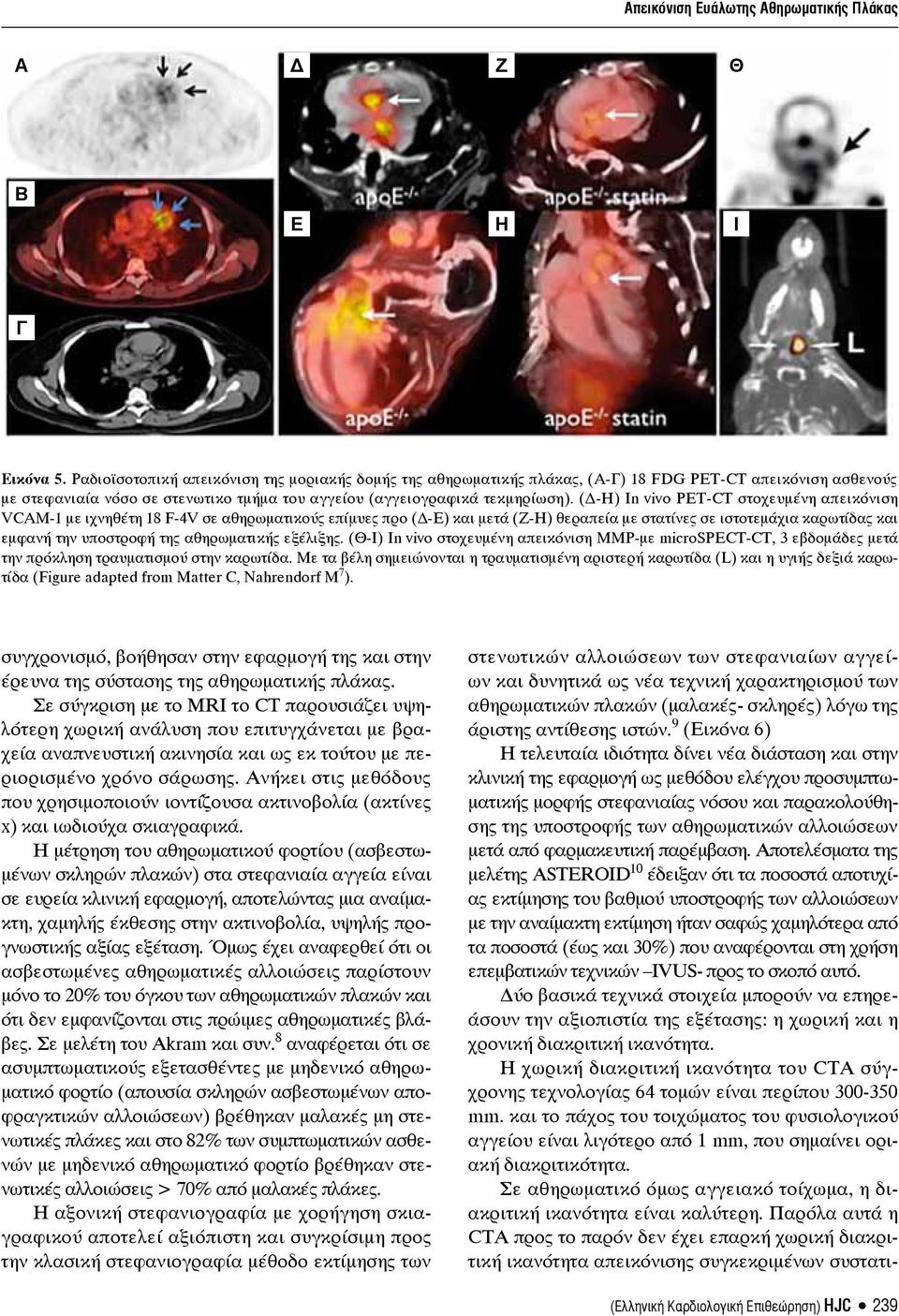 (Δ-Η) In vivo PET-CT στοχευμένη απεικόνιση VCAM-1 με ιχνηθέτη 18 F-4V σε αθηρωματικούς επίμυες προ (Δ-Ε) και μετά (Ζ-Η) θεραπεία με στατίνες σε ιστοτεμάχια καρωτίδας και εμφανή την υποστροφή της