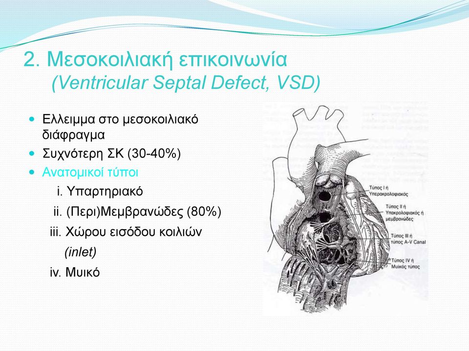 (30-40%) Ανατομικοί τύποι i. Υπαρτηριακό ii.