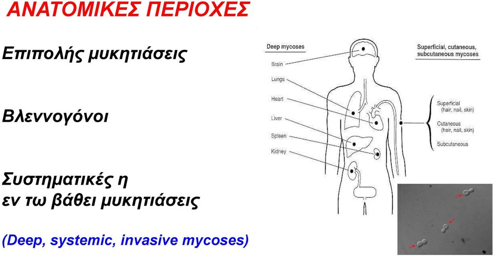 Συστηματικές η εν τω βάθει