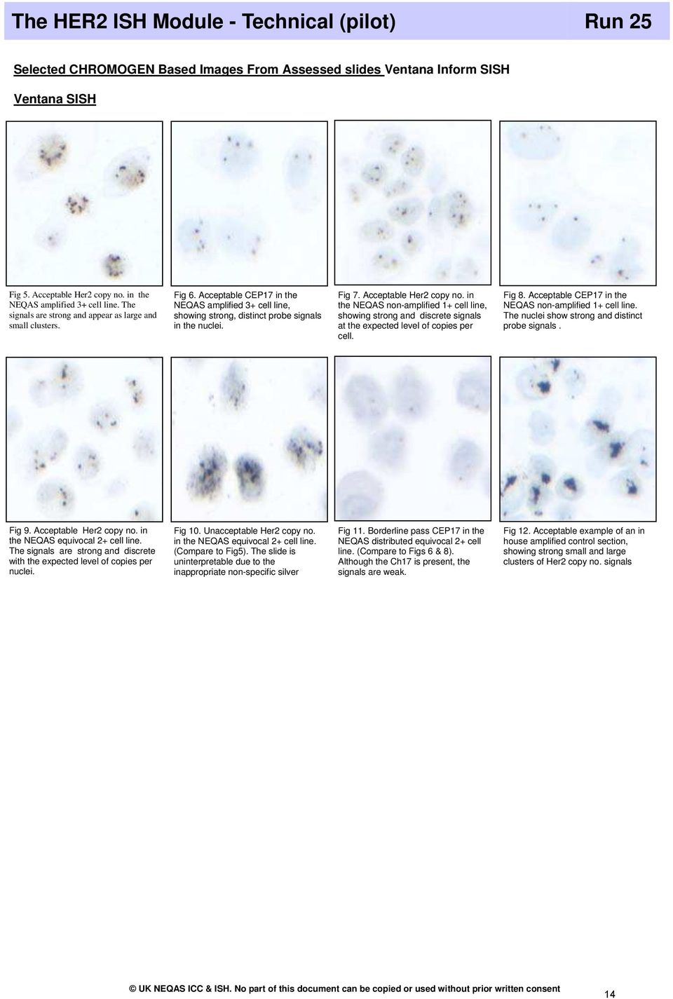 Acceptable CEP17 in the NEQAS amplified 3+ cell line, showing strong, distinct probe signals in the nuclei. Fig 7. Acceptable Her2 copy no.