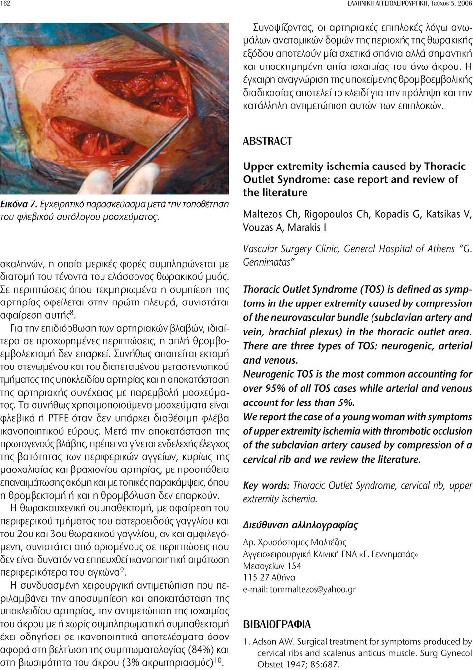 ABSTRACT Εικόνα 7. Εγχειρητικό παρασκεύασμα μετά την τοποθέτηση του φλεβικού αυτόλογου μοσχεύματος. σκαληνών, η οποία μερικές φορές συμπληρώνεται με διατομή του τένοντα του ελάσσονος θωρακικού μυός.