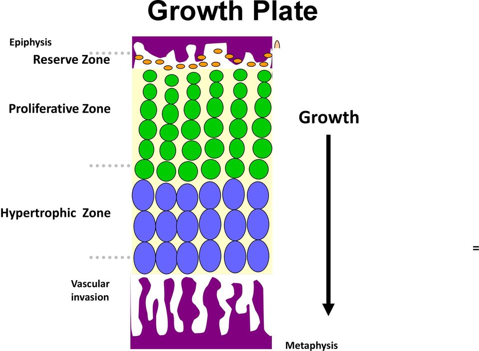 Differentiation Hypertrophic Zone Vascular invasion Chondrocytes