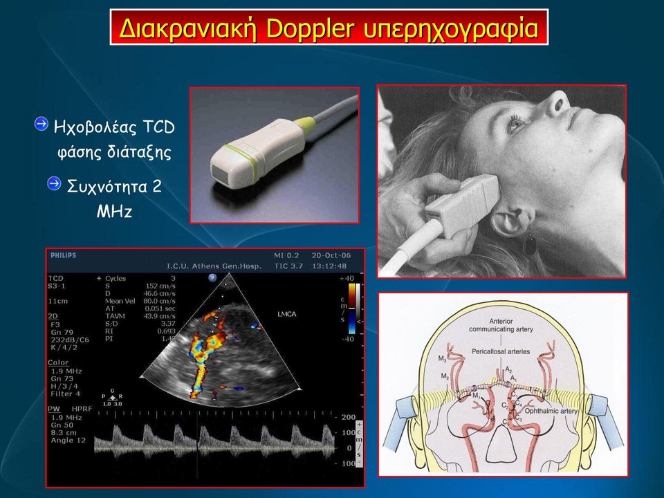 Ηχοβολέας TCD φάσης